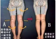 盆腔私密,女性健康与美丽的关键