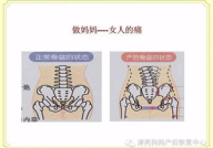 骨盆私密保养,揭秘骨盆私密保养之道
